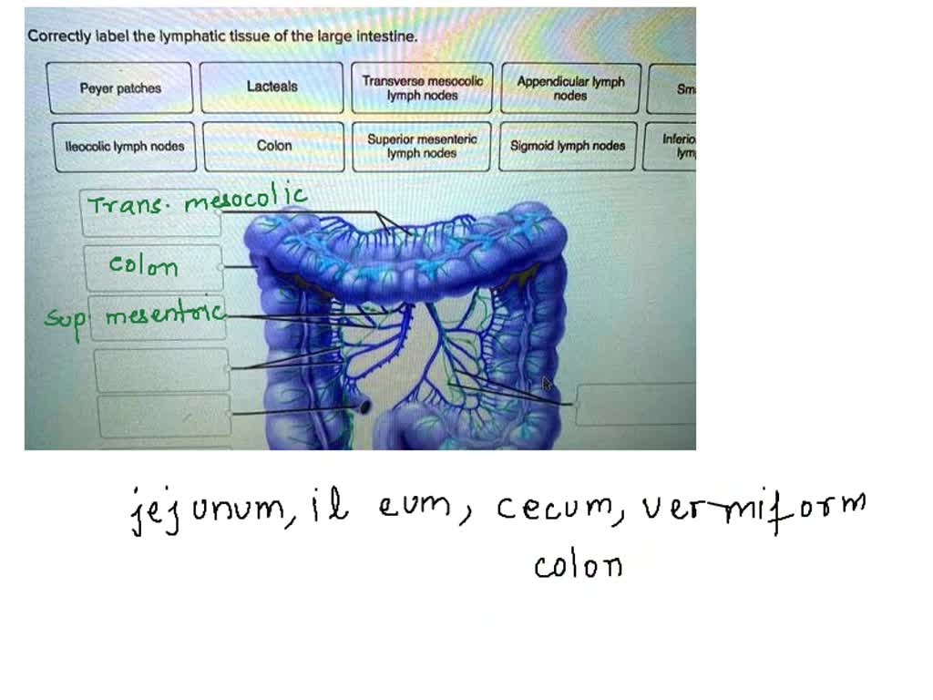 Solved: Major Lymphatic Trunks Lymphatic Trunk Regions Drained Right 