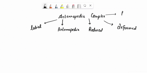 the-homeotic-mutation-antennapedia-causes-mutant-drosophila-to-have-legs-in-place-of-antennae-and-is-85573