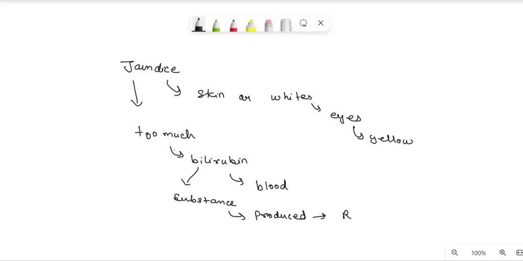 SOLVED A 7 year old child is admitted to a hospital with jaundice but