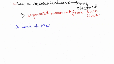 when-wave-0f-depolarization-travels-toward-lead-how-is-this-represented-on-an-ecg-tracing-when-wave-0f-repolarization-travels-toward-a-lead-how-i5-this-represented-on-an-ecg-tracing-negative-98924
