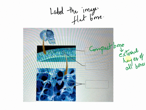 correctly-label-the-following-anatomical-parts-of-a-flat-bone-trabeculae-long-bone-spongy-bone-spicules-compact-bone-reset-zoom-17426