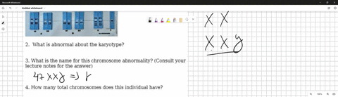 examine-karyotype-below-what-is-abnormal-about-the-karyotype-3-what-is-the-name-for-this-chromosome-abnormality-consult-your-lecture-notes-for-the-answer-4-how-many-total-chromosomes-does-th-16083