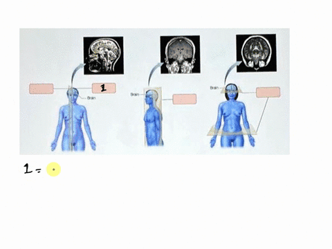 art-labeling-activity-planes-of-section-the-language-of-anatomy-art-labeling-activityplanes-of-section-parta-drag-the-appropriate-labels-to-their-respective-targets-rosethelp-iransvees-plann-39406