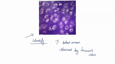 3-name-the-connective-tissue-seen-on-this-image-26022