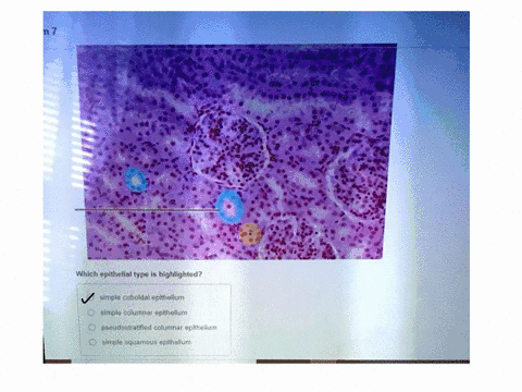 n7-which-epithelial-type-is-highlighted-simple-cuboidal-epithellum-simple-columnar-epithelium-pseudostratifled-columnar-eplthelium-simple-squamous-epithellum-53246