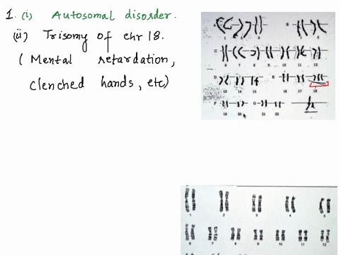 lab-14-_-karyotyping-c221-t-jcc-0-6j-p1f-1171_2-0-41-i-hutosoma-sex-chromosomes-disorcer-describe-the-inregularity-name-disoraen-what-the-gender-of-this-indivicual-rutosomat-chromosomes-diso-34177