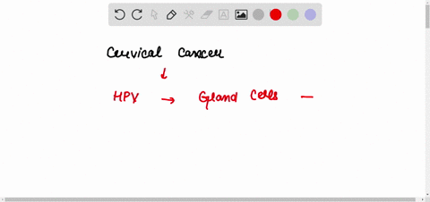which-one-of-the-following-viruses-is-associated-with-cervical-cancer-treponema-pallidum-chlamydia-trachomatis-herpes-simplex-virus-human-papilloma-virus-hepatitis-b-62257