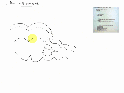 draw-and-label-please-spinal-cord-models-not-all-structures-seen-on-allmodels-meningeal-layerseach-layer-is-a-meninx-dura-mater-oarachnoid-mater-o-pia-mater-denticulate-ligament-filumtermina-28932