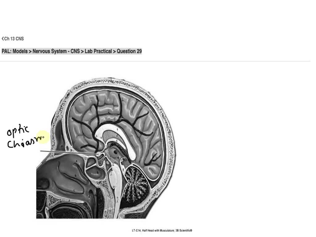 SOLVED: PAL: Models > Nervous System - CNS > Lab Practical > Question ...