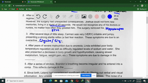 anatomy-of-the-nervous-system-human-dovelopment-for-nursing-alter-traumalic-car-accident-jakc-exhibiled-hemlparesis-weakness-paralysis-of-side-of-his-body-dysarthria-slurred-speech-alaxia-a-65103