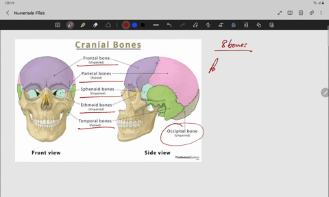 which-of-the-bones-below-is-not-a-bone-of-the-brain-case-a-temporal-bone-b-occipital-bone-c-zygomatic-bone-d-frontal-bone