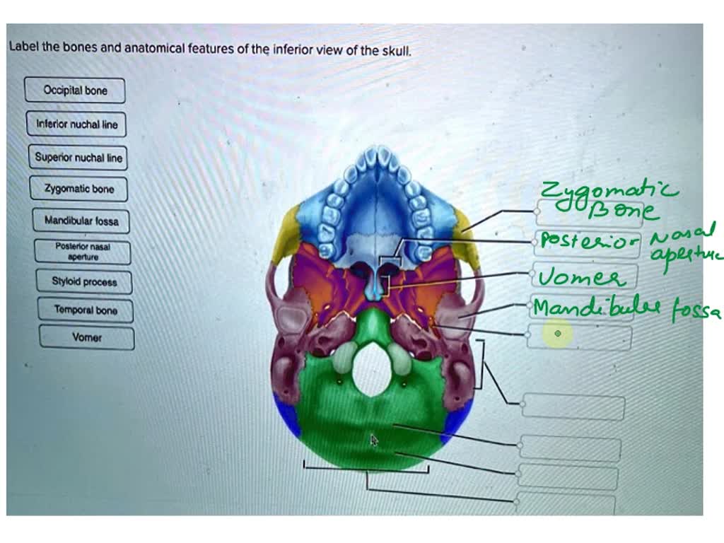 Solved Label The Bones And Anatomical Features Of The Inferior View Of The Skull Occipital Bone 0530