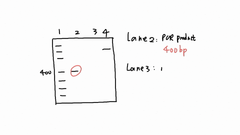 below-is-an-example-of-an-agarose-gel-that-you-need-to-interpret_-pcr-was-done-on-3-plant-samples-using-primers-that-should-result-in-a-400-bp-base-pair-product-the-pcr-reactions-lanes-2-3-a-13143