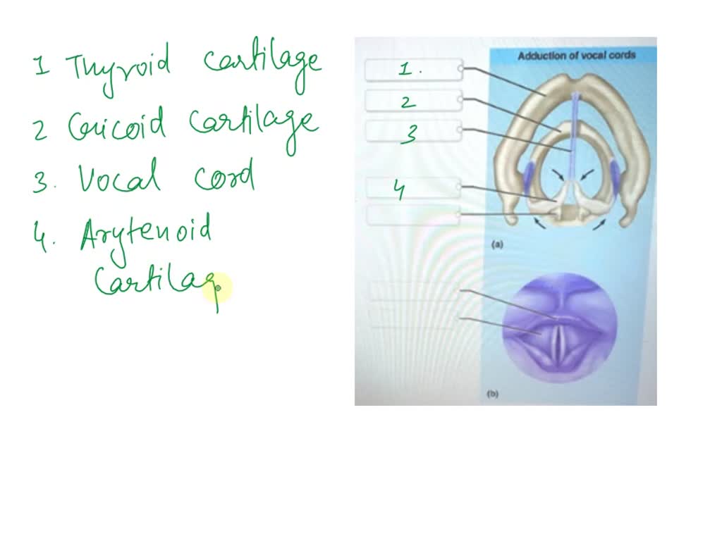 SOLVED: Correctly Label The Anatomical Features Of The, 49% OFF