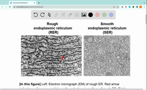 which-organelles-are-sometimes-referred-to-as-rough-or-smooth-depending-on-their-appearance-in-electron-micrographs-a-lysosomes-b-ribosomes-golgi-bodies-dmitochondria-endoplasmic-reticula-36985