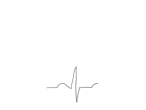 how-is-ventricular-depolarization-is-represented-on-the-eck-a-p-wave-b-qrs-complex-c-t-wave-d-none-of-the-above