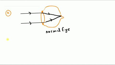 1describe-the-path-traveled-by-a-ray-of-light-as-it-enters-the-eye-and-passes-to-the-retina-2-list-the-three-tunics-of-the-eye-and-their-respective-components-3locate-the-blind-spot-for-each-76402