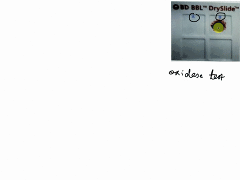 two-dineret-bacton-v-o8d-bbl-dryslide-which-of-the-following-statements-are-true-regarding-the-picture-the-oxidase-test-results-above-specimen-termented-cyochrom-oxidase-bdecimen-produces-cv-74573