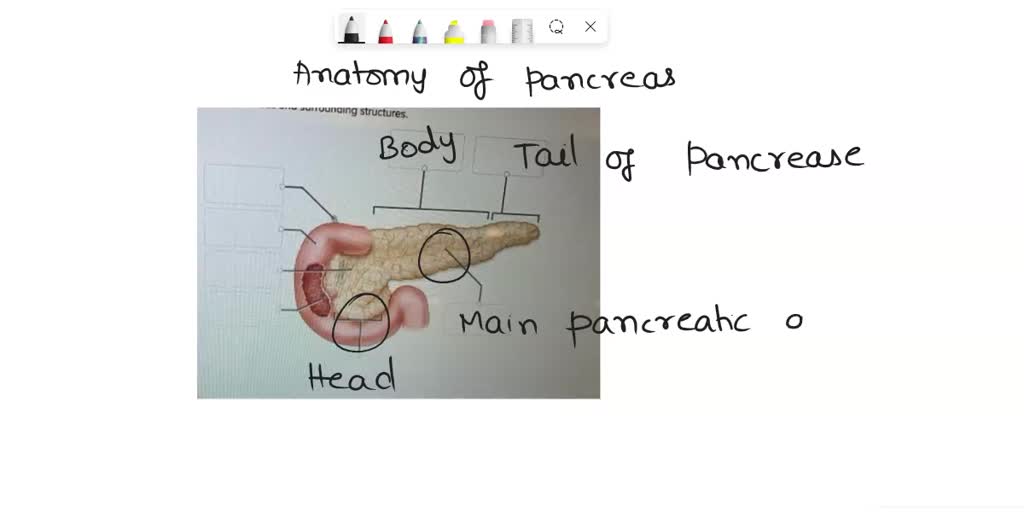 solved-label-the-gross-anatomy-of-the-pancreas-and-surrounding