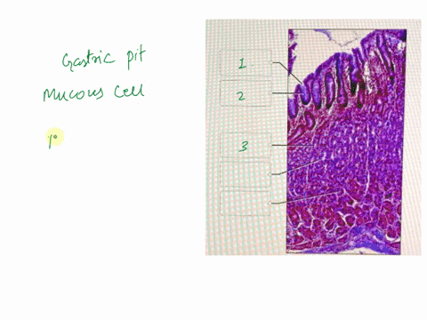 light-micrograph-of-the-stomach-lining-in-the-light-micrograph-of-the-stomachlabel-the-structures-associated-with-the-mucosa-of-the-stomach-wall-chief-cell-serosa-parietal-cell-mucous-cell-g-15906