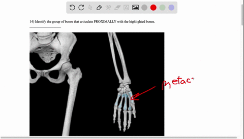 14-identify-the-group-of-bones-that-articulate-proximally-with-the-highlighted-bones-94252