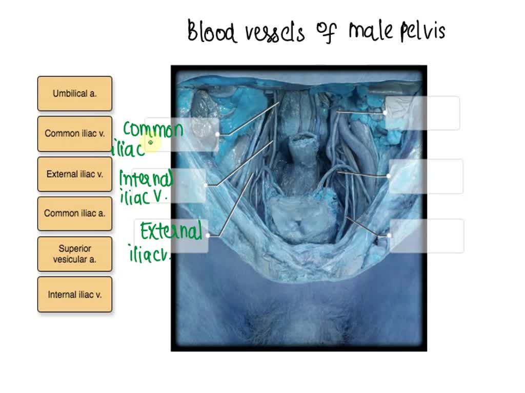 SOLVED: Label the blood vessels of the female pelvis using the hints