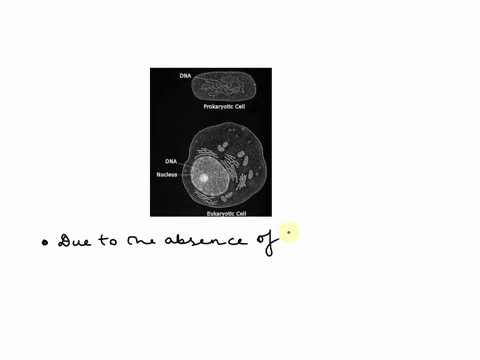 looking-at-a-cell-under-a-microscope-you-note-that-it-is-a-prokaryote-how-do-you-know-47675