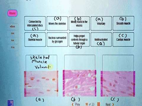 18-determine-which-muscular-tissue-type-each-image-below-represents-then-click-and-drag-the-labels-placing-them-in-the-correci-category-connected-by-intercalated-discs-moves-the-skeleton-mos-31232