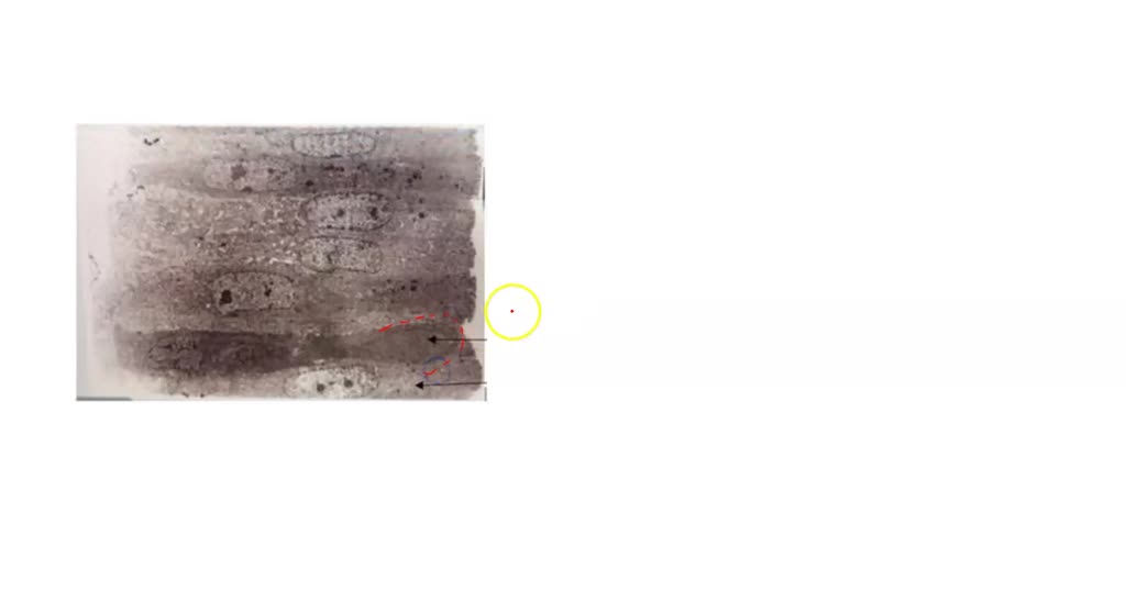 SOLVED Transmission electron Zoom Level Day 1 0830 PROGRESS 8790 Zoom