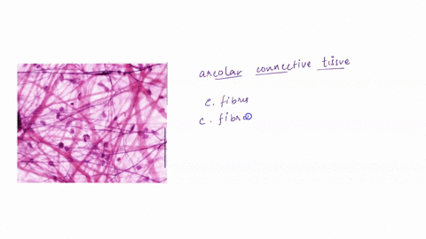 a-name-the-most-commonly-seen-connective-tissue-in-the-image-below-b-what-structure-is-inside-the-red-circle-and-how-can-you-tell-c-what-type-of-collagen-fiber-is-the-most-prevalent-in-all-c-94124