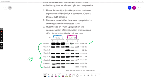 crohn-disease-cd-is-type-of-inflammatory-bowel-disease-characterized-by-abdominal-pain-diarrhea-vomiting-and-weight-loss-among-other-things-dysfunctional-barriers-between-intestinal-epitheli-52512