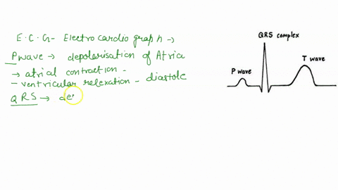 the-p-wave-corresponds-t0-depolarization-ofthe-muscle-fibers-of-the-the-qrs-complex-corresponds-to-depolarization-of-the-muscle-fibers-of-the-the-t-wave-corresponds-t0-repolarization-of-the-26112