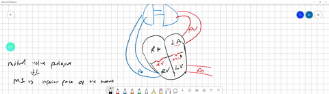 activity-2-mr-helms-was-admitted-to-the-hospital-with-chest-pain-and-shortness-of-breath-he-has-history-of-heart-disease-a-medical-examination-and-an-ecg-determined-that-mr-helms-had-a-heart-95762