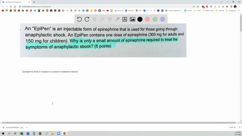 an-epipen-is-an-injectable-form-of-epinephrine-that-is-used-for-those-going-through-anaphylactic-shock-an-epipen-contains-one-dose-of-epinephrine-300-mg-for-adults-and-150-mg-for-children-wh-78566