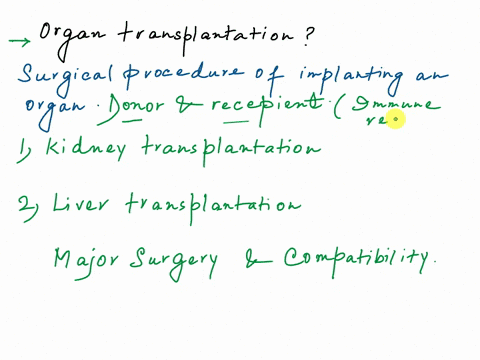 write-academic-essay-not-less-than-700-about-organ-transplantation-the-essay-should-include-the-main-parts-of-writing-an-essay-introduction-body-conclusion-references-writing-should-follow-a-62128