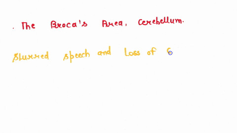 1-8-multiple-choice-1-point-1-slurred-speech-and-loss-of-coordination-produced-by-exposure-to-pcp-likely-effects-qquad-and-qquad-regions-of-the-brain-2-the-occipital-lobe-lateral-ventricles-the-reticu