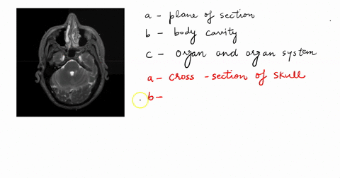 take-moment-to-examine-the-picture-below-1-pt-in-the-picture-above-what-plane-of-section-is-demonstrated-1-pt-in-the-picture-above-what-body-cavity-is-seen-1-pt-_-for-the-body-cavity-named-a-62003