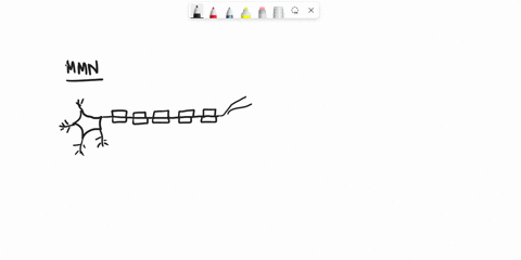 draw-a-simple-diagram-of-a-myelinated-motor-neuron-label-the-major-structures-that-constitute-this-neuron-using-an-arrow-indicate-the-direction-of-receipt-and-transmission-of-nerve-impulses-91805