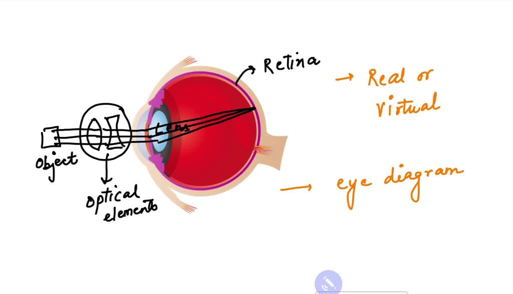 SOLVED Eyeglasses and contact lenses are used to correct the location