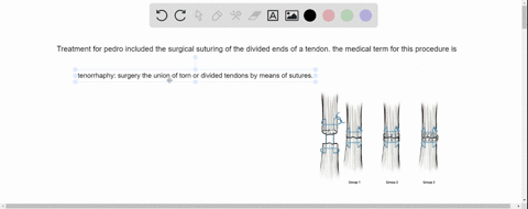 treatment-for-pedro-included-the-surgical-suturing-of-the-divided-ends-of-a-tendon-the-medical-term-for-this-procedure-is-44812