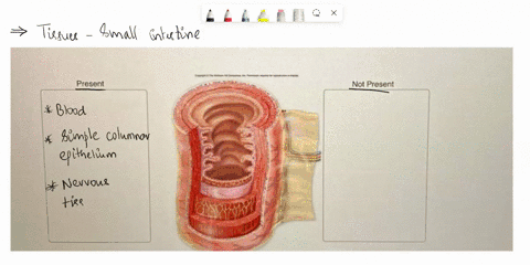 organs-are-composed-of-more-than-one-tissue-type-working-together-to-perform-a-specific-set-of-functions-the-small-intestine-shown-here-is-lined-with-a-mucous-membrane-contains-neurons-that-14792