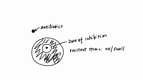 using-ruler-measure-the-zone-of-inhibition-on-the-images-providedin-the-vareetoatee-maloratroa-tein-dtto-oentea-lab-report-section-c2-for-each-antibiotic-dikmpent-tont-tested-in-each-experim-12005