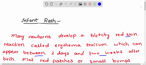 infant-rash