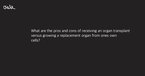 what-are-the-pros-and-cons-of-receiving-an-organ-transplant-versus-growing-a-replacement-organ-from-ones-own-cells-59556