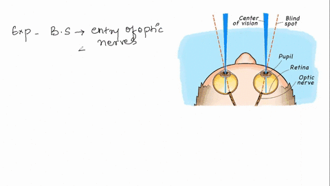 2-the-blind-spot-is-located-medial-to-the-eye-for-instance-the-blind-spot-for-the-left-eye-would-be-towatrds-the-right-not-towards-the-left-true-or-false-26276