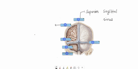 label-the-cranial-dura-septa-and-associates-sinuses-label-the-cranial-dura-septa-and-associated-sinuses-tentorium-cerebelli-fabx-cerebelli-superior-sagittal-sinus-transverse-sinus-superior-s-14855