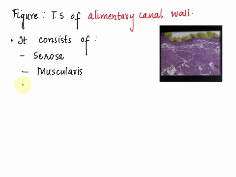 which-structure-is-highlighted-multtple-cholce-o-detrussor-muscle-lamina-proprla-submucosa-cremaster-muscle-transitional-epithelium-28672