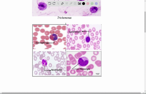 neutrophil-_-these-cells-have-faint-light-pink-granules-in-the-cytoplasm-and-characterstic-lobulated-nucleu-the-more-mane-the-neutrophil-the-more-lobes-you-will-find-these-cel-ciculate-mthe-67778