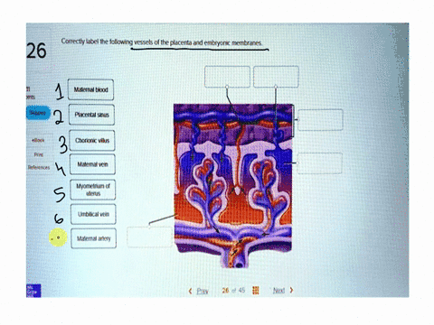 correctly-label-the-following-vessels-of-the-placenta-and-embryonic-membranes-26-11-ents-maternal-blood-placental-sinus-ebook-chorionicvillus-print-references-maternal-vein-myometrium-of-ute-73588