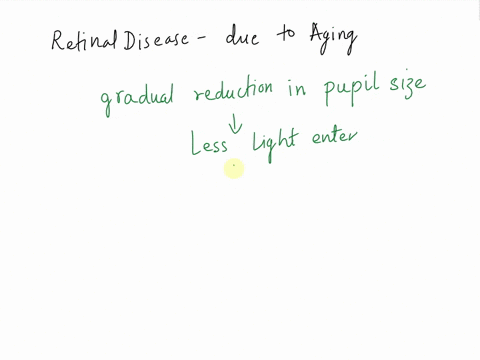 as-people-age-their-ability-to-see-at-night-decreases-what-changes-in-the-retina-might-explain-this-a-clinician-shines-a-light-into-a-patients-left-eye-and-neither-pupil-constricts-shining-t-40313